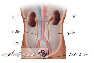 مطالبی در مورد ( برگشت ادرار و عفونت ادراری)